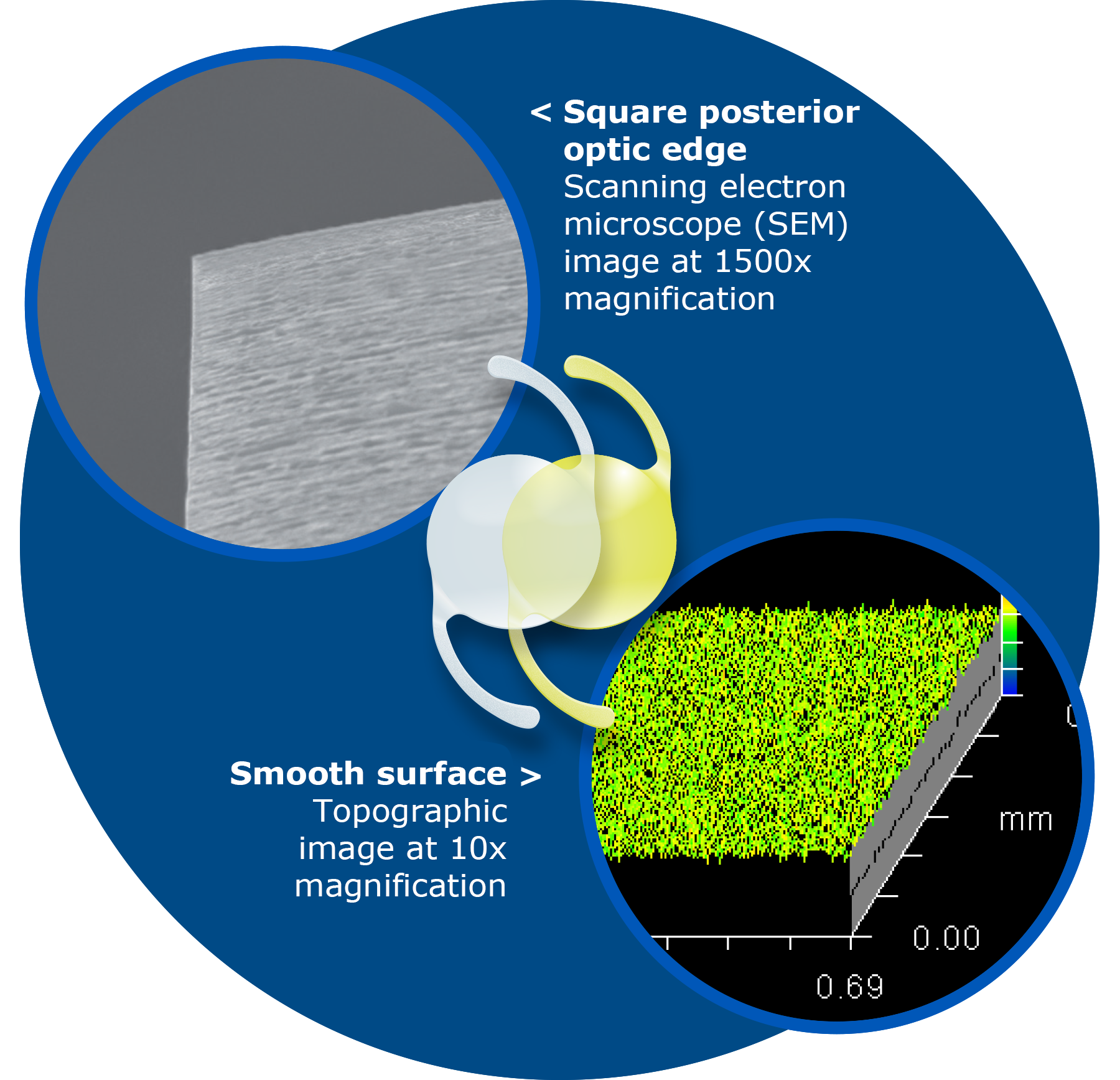 Vivinex™ IOLs - Hoya Surgical Optics Clarity & Support
